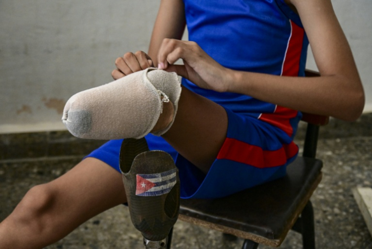 Juan Jose Guilarte protège son moignon avant de mettre sa prothèse pour une session d'entraînement de pentathlon à La Havane, le 16 avril 2026 à Cuba ( AFP / YAMIL LAGE )