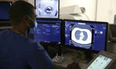 Un radiologue observe son écran alors qu'il réalise un scanner des poumons sur une femme fumeuse, le 16 décembre 2021 à Ajaccio ( AFP / Pascal POCHARD-CASABIANCA )