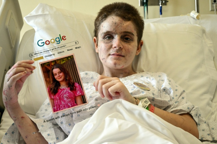 La Libanaise Aseel, 13 ans, fille d'Amani Bazzi, pose dans un hôpital de Beyrouth avec une photo d'elle-même, prise avant qu'elle ne soit grièvement blessée par une frappe israélienne, le 25 novembre 2025  ( AFP / Joseph EID )