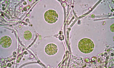 Fermentalg produit des acides gras oméga-3 grâce à des microalgues. (© cc Universidad EAFIT)