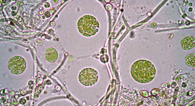 Fermentalg produit des acides gras oméga-3 grâce à des microalgues. (© cc Universidad EAFIT)