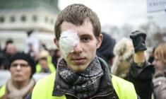 Franck Didron à Paris le 2 février 2019, deux mois après avoir été blessé lors d'une manifestation de gilets jaunes ( AFP / LUCAS BARIOULET )