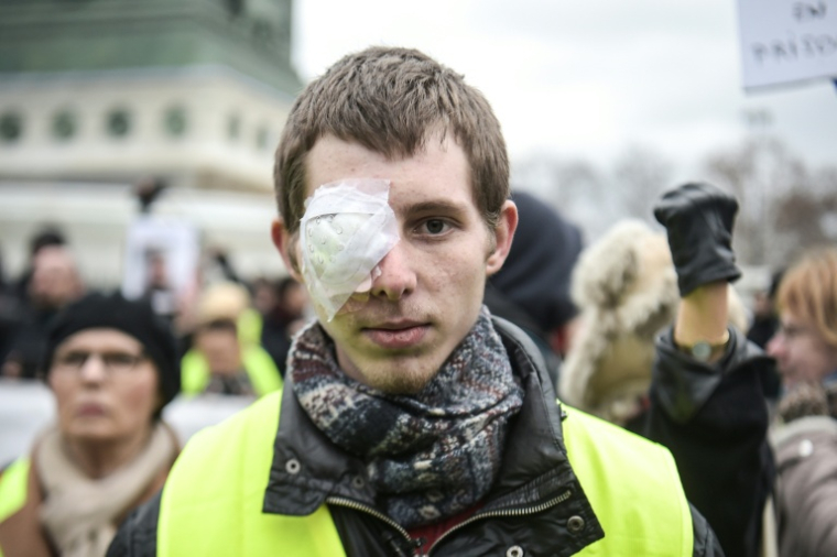 Franck Didron à Paris le 2 février 2019, deux mois après avoir été blessé lors d'une manifestation de gilets jaunes ( AFP / LUCAS BARIOULET )