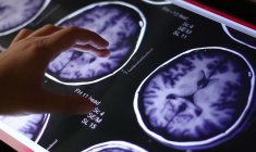 Guerbet est une medtech spécialisée dans l'imagerie médicale. (© Guerbet)
