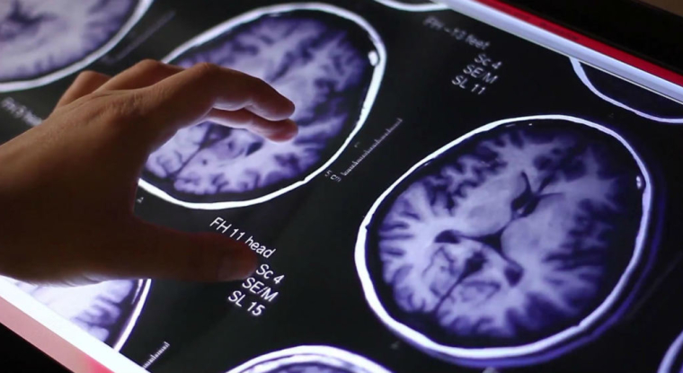 Guerbet est une medtech spécialisée dans l'imagerie médicale. (© Guerbet)