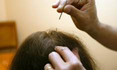 Aromathérapie, acupuncture, réflexologie, ou encore homéopathie, l'existence dans certaines universités de diplômes pour des pratiques de soins non conventionnelles préoccupe des professionnels de santé ( AFP / JEAN-PIERRE MULLER )