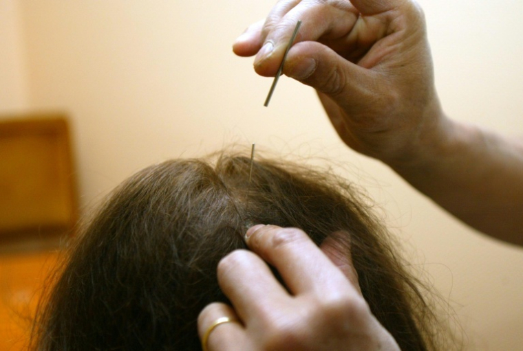 Aromathérapie, acupuncture, réflexologie, ou encore homéopathie, l'existence dans certaines universités de diplômes pour des pratiques de soins non conventionnelles préoccupe des professionnels de santé ( AFP / JEAN-PIERRE MULLER )