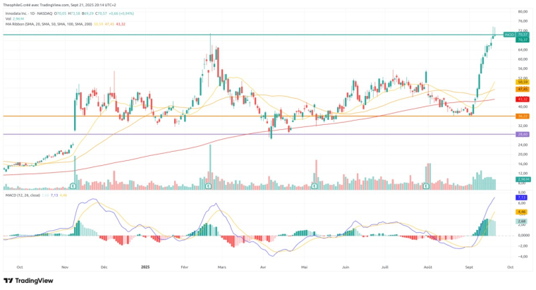 Source : TradingView