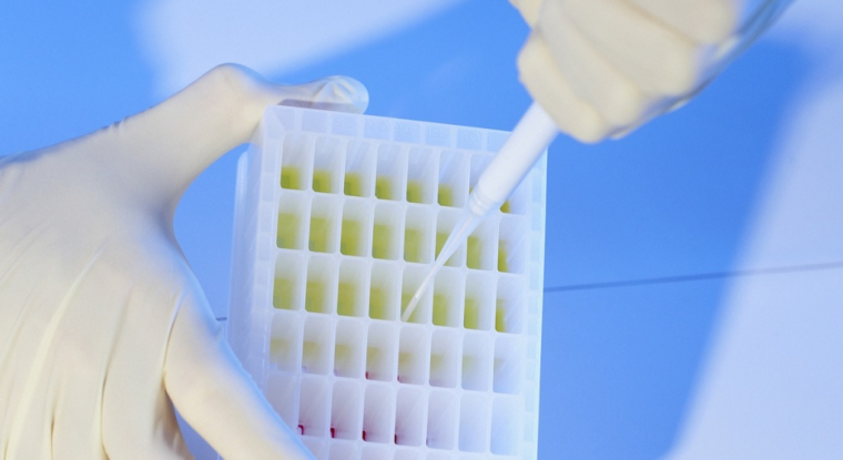 Genfit discute actuellement du protocole des études de phase III de son candidat-médicament contre la Nash avec les autorités sanitaires américaines. (© DR)
