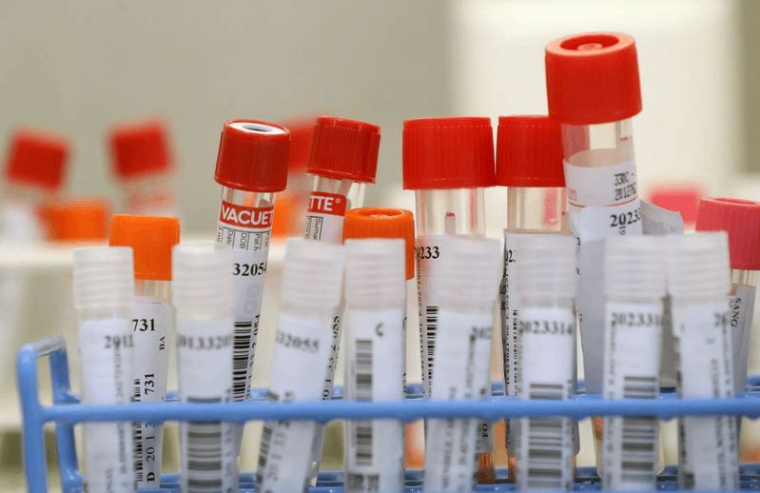 CORONAVIRUS: LE TRANSPORT AÉRIEN PRÔNE DES TESTS POUR ÉVITER LES QUARANTAINES