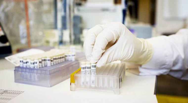 Ipsen et Exelixis ont signé un accord exclusif de licence de commercialisation du cabozantinib le 29 février dernier. (© Ipsen)