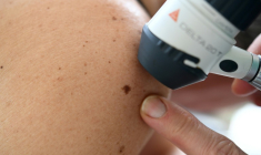 Une dermatologue examine un grain de beauté sur une patiente, le 22 mai 2019 à Quimper ( AFP / Fred TANNEAU )
