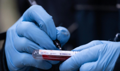 La "vitesse de sédimentation" réalisé plusieurs millions de fois par année en France, n'a qu'un intérêt limité et ne devrait plus être prescrit selon l'HAS. ( AFP / SEBASTIEN BOZON )