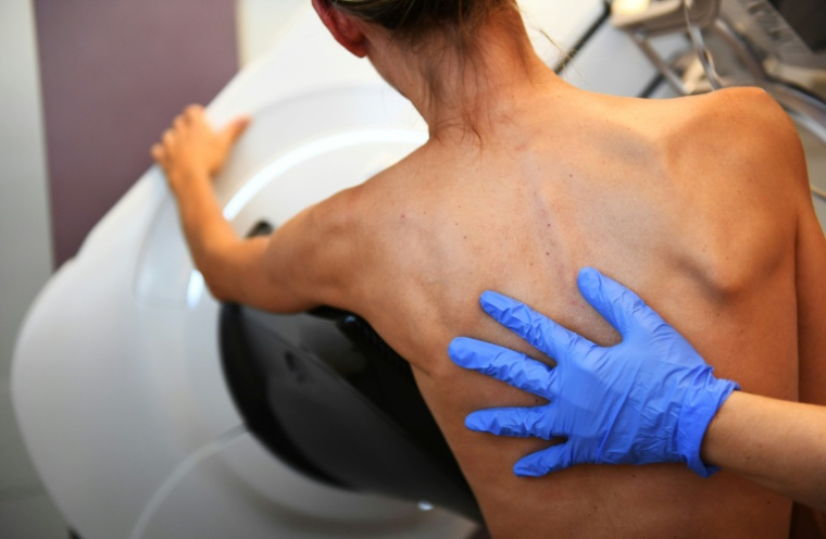 Une patiente passe une mammographie le 9 octobre 2017, à l'institut Paoli-Calmette, à Marseille ( AFP / ANNE-CHRISTINE POUJOULAT )