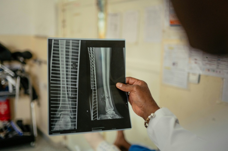 Le chirurgient Amadou Soumah Sékou examine la radiographie d'un patient à l'hôpital de Goma, soutenu par le Comité international de la Croix-Rouge (CICR), le 14 mai 2026 en RDC ( AFP / Jospin Mwisha )
