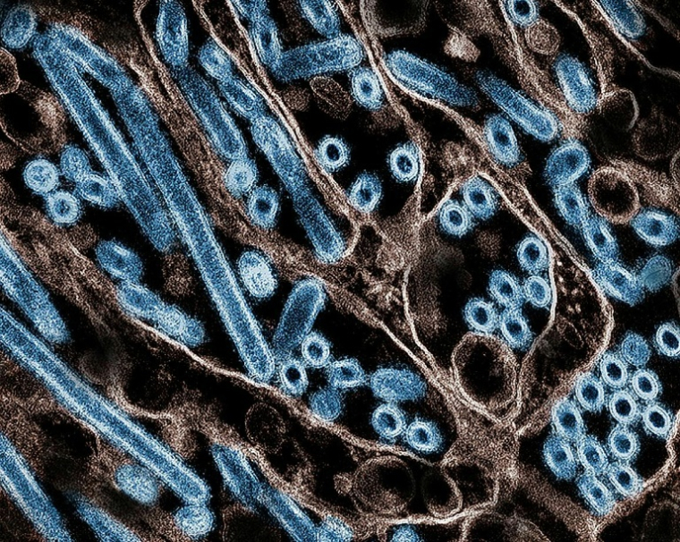 Une image de particules du virus de la grippe aviaire A H5N1 (en bleu), obtenue le 22 novembre 2024 auprès des Centres américains de prévention et de lutte contre les maladies et de l'Institut national des allergies et des maladies infectieuses ( National Institute of Allergy and Infectious Diseases / HANDOUT )
