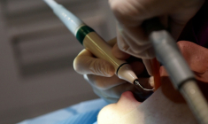 Plus de la moitié (52%) des dentistes contrôlés ne respectaient pas l'obligation "d'affichage des prix" dans la salle d’attente ou "d’informations sur le conventionnement" avec l'Assurance maladie ( AFP / LOIC VENANCE )
