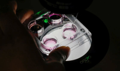 BIOMÉRIEUX CHUTE EN BOURSE, DÉCEPTION SUR L'OPÉRATIONNEL ET LES PRÉVISIONS