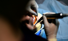 Un ex-dentiste de 61 ans comparaît devant le tribunal correctionnel de Mende (Lozère), accusé d'avoir escroqué la sécurité sociale en pratiquant des opérations médicalement injustifiées et bâclées ayant occasionné des mutilations chez des dizaines de ses patients ( AFP / LOIC VENANCE )