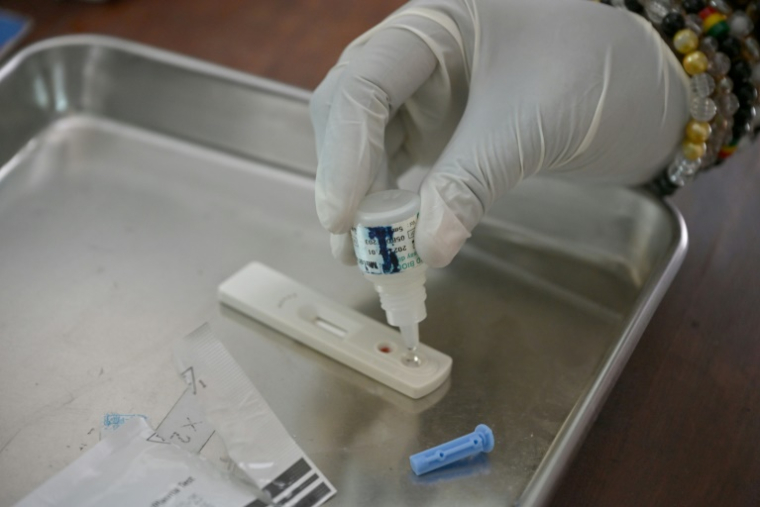 Une analyse de sang au laboratoire du Centre d'accueil, de soins et d'accompagnement (CASA) à Abidjan le 26 août 2025, en Côte d'Ivoire ( AFP / Issouf SANOGO )