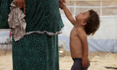 Rouba, une petite Palestinienne souffrant de la varicelle, selon les médecins, dans la tente familiale dans le camp de Khan Younes, à Gaza, le 19 juillet 2026 ( AFP / Bashar Taleb )