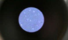 Des spermatozoïdes humains observés au microscope, le 17 novembre 2024 à Rennes ( AFP / Damien MEYER )