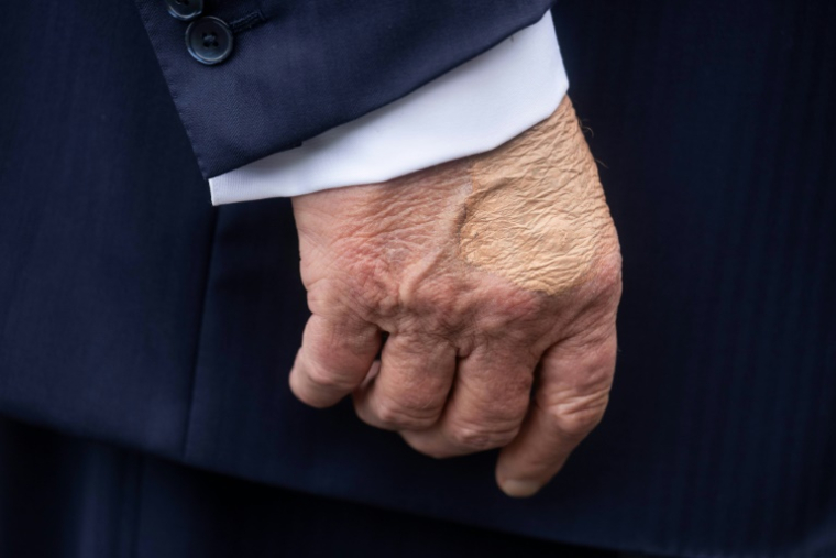 La main droite du président américain Donald Trump avant d'embarquer à bord de l'hélicoptère Marine One à la Maison Blanche, le 15 juillet 2025 à Washington ( AFP / Jim WATSON )