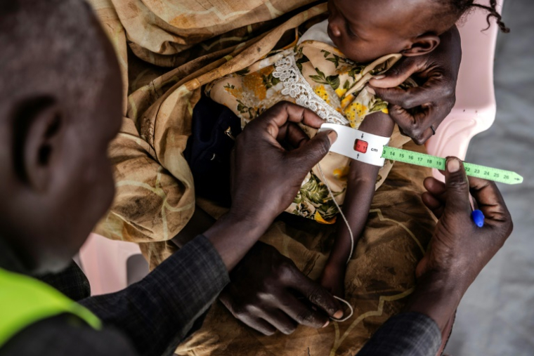 Un employé d'un centre de soins mesure la circonférence du bras d'un enfant à Renk, au Soudan du Sud, le 13 février 2024 ( AFP / LUIS TATO )