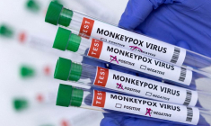 L'UE VA ACHETER 110.000 VACCINS CONTRE LA VARIOLE DU SINGE À BAVARIAN NORDIC