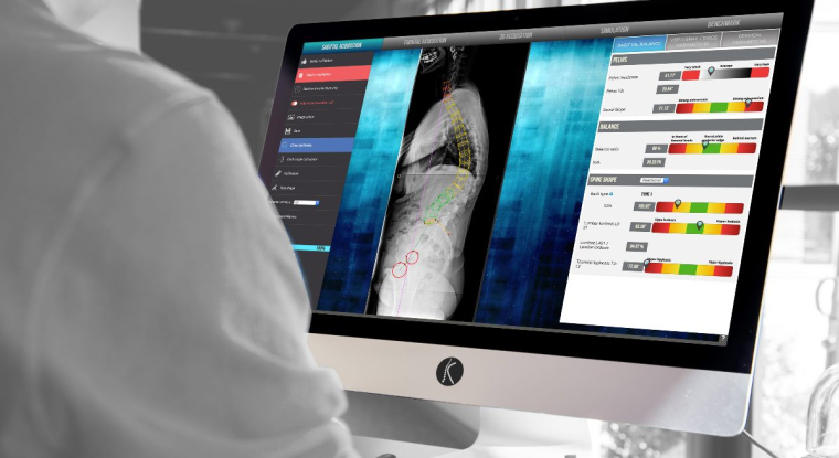 La medtech a levé 9 millions d'euros lors de son introduction en Bourse. (© SMAIO)