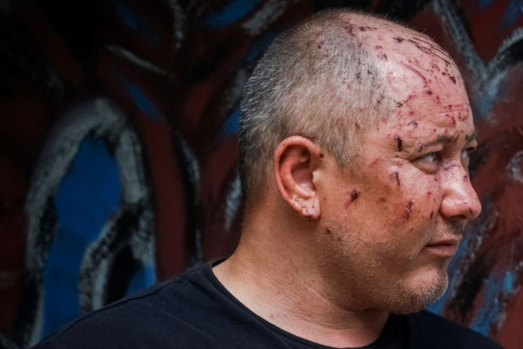 Un homme, blessé lors d'une frappe de missile russe à Kyiv