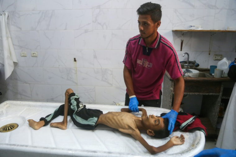 Un médecin nettoie le corps du jeune Palestinien Abdel Jawad al-Ghalban, 14 ans, décédé de faim à la morgue de l'hôpital Nasser à Khan Younès, dans le sud de la bande de Gaza, le 22 juillet 2025 ( AFP / - )