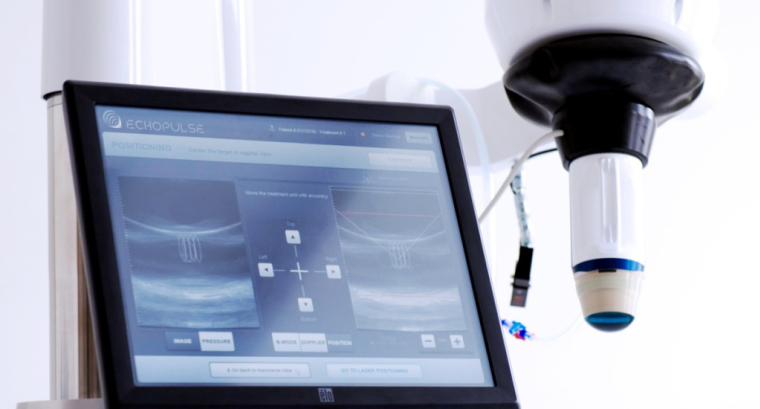 Echopulse, l’appareil d'échothérapie innovant développé par Theraclion. (© Theraclion)