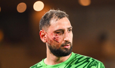 L'impressionnante balafre de Donnarumma au visage
