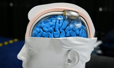 Un implant Wimagine de CEA pour aider les patients atteints de lésions de la moelle épinière à remarcher, est présenté au Consumer Electronics Show (CES), le 7 janvier 2024 à Las Vegas, dans le Nevada ( AFP / Frederic J. BROWN )