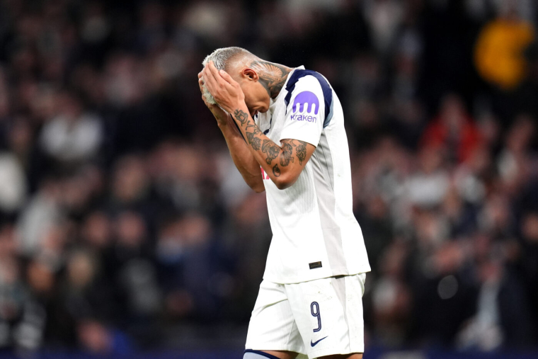 Tottenham lutte contre la calvitie à sa manière