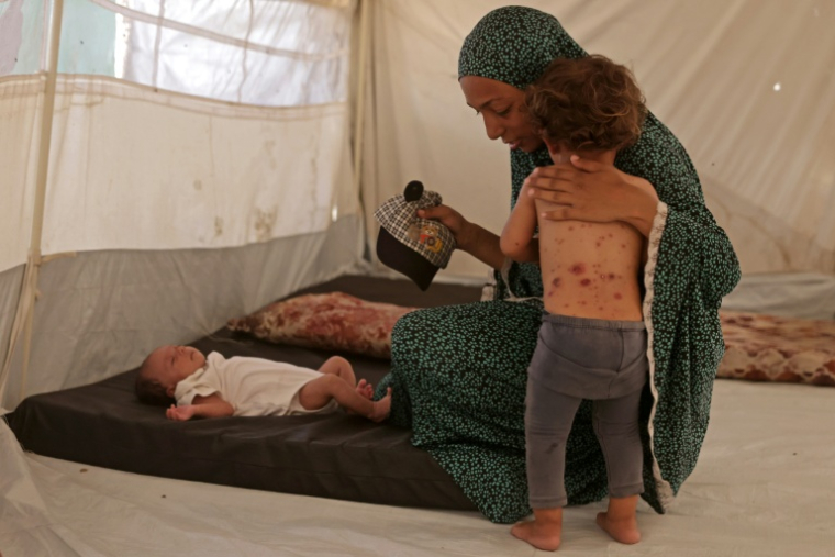 Rouba, enfant palestinienne, souffrant de varicelle, avec sa mère sous unbe tente à Khan Younes, dans la bande de Gaza, le 19 juillet 2026  ( AFP / Bashar Taleb )