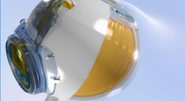 Le dispositif IRIS de Pixium. (© Pixium)