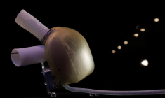 CARMAT VEUT POURSUIVRE SON INTERNATIONALISATION, VISE LES USA