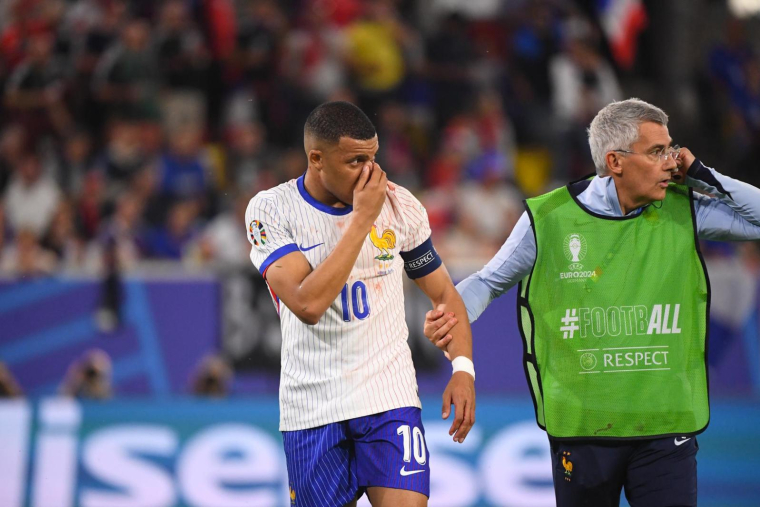 La FFF communique sur la blessure au nez de Mbappé