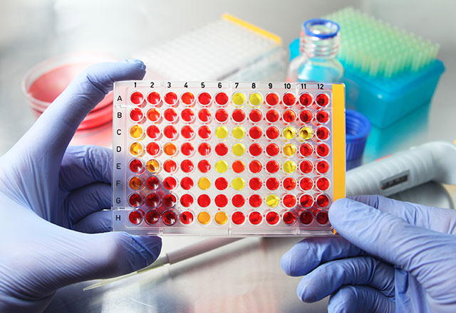 La biotech strasbourgeoise a en effet annoncé la cession de la part de 50% qu'elle détient au capital de la coentreprise, qu'elle a créée en Chine en 2012 avec Tasly biopharmaceuticals.