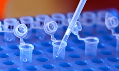 Sanofi apporte 10 millions à la biotech lyonnaise spécialisée dans le traitement du diabète et de l’obésité. (© DR)