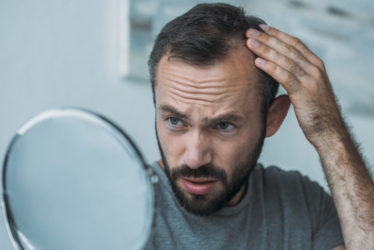 La phase de croissance du cheveu dure environ 2 à 5 ans chez l'homme et 3 à 7 ans chez la femme. (crédit : Adobe Stock)