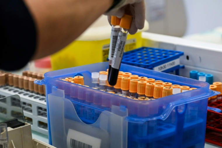 Le réseau de laboratoires de biologie médicale Cerballiance en France a annoncé vendredi avoir été victime fin mars d'une attaque informatique ayant entraîné "un accès non autorisé" à des données personnelles de "certains de ses patients" ( AFP / DENIS CHARLET )