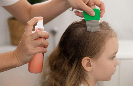 Il existe des alternatives aux shampoings toxiques pour se débarrasser des poux. ( crédit photo : Shutterstock )