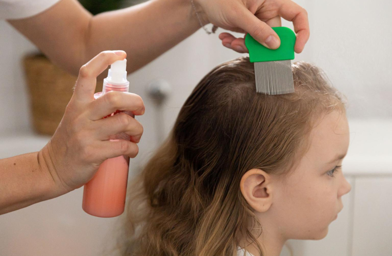 Il existe des alternatives aux shampoings toxiques pour se débarrasser des poux. ( crédit photo : Shutterstock )