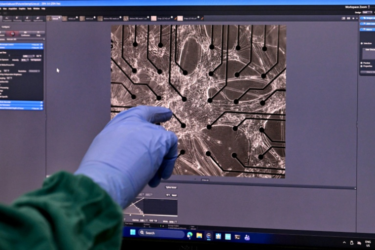 Vue microscopique de  neurones cultivés en laboratoire dans les locaux de l'entreprise australienne Cortical Labs à Melbourne, le 5 mai 2026 ( AFP / William WEST )