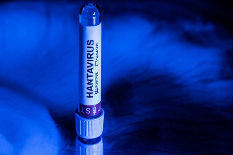 Hantavirus: pour les experts, le défi d'informer sans réveiller la peur du Covid ( AFP / Joel Saget )