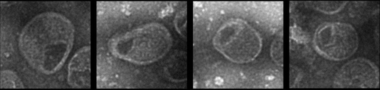 Images non datées, diffusées par Cell Press le 6 mars 2026, montrant un reptarenavirus de serpent seul, sans deltavirus ( Cell Press / Handout )
