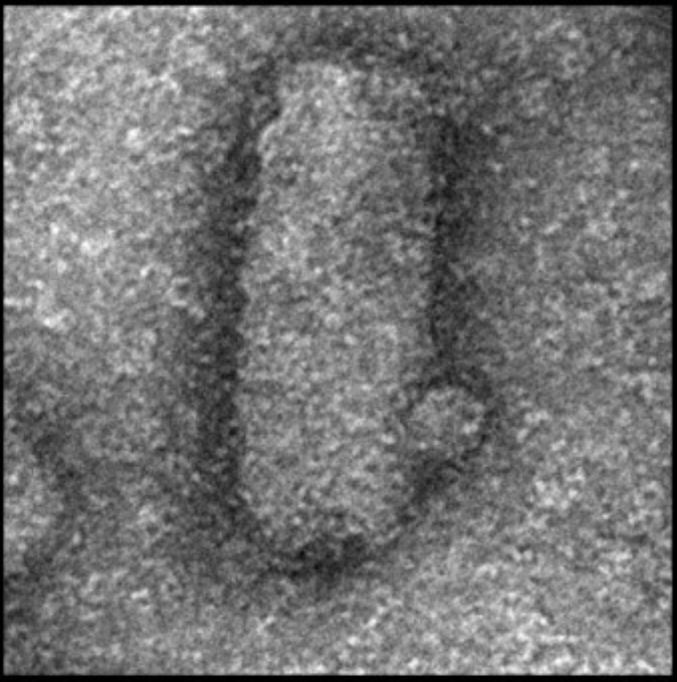 Image non datée, diffusée par Cell Press le 6 mars 2026, montre un virus de la stomatite vésiculaire (VSV) (particule allongée) et un deltavirus de rongeur ( Cell Press / Handout )